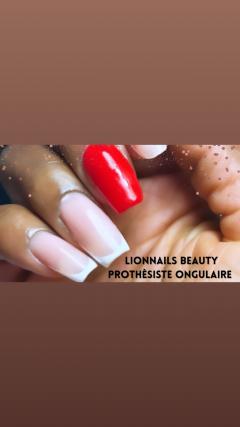 Service prothesiste ongulaire