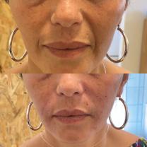 Service estheticienne