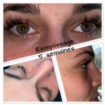 Service extension de cils